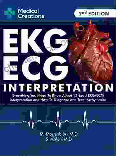 EKG/ECG Interpretation: Everything You Need To Know About The 12 Lead ECG/EKG Interpretation And How To Diagnose And Treat Arrhythmias: 2nd Edition